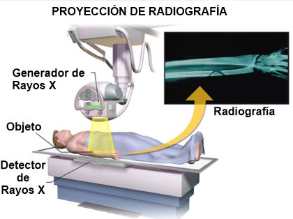 Proyección Radiográfica